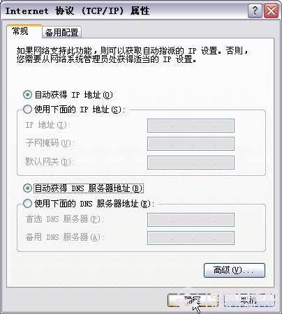 自动访问 IP 和 DNS 地址是本地连接的默认设置 。