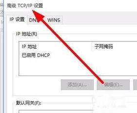 win10高级tcpip默认设置