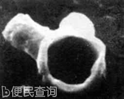 弗莱明发明青霉素