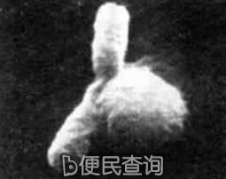 弗莱明发明青霉素