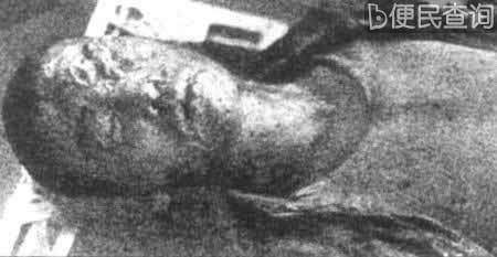 日军对中国军队进行毒气战